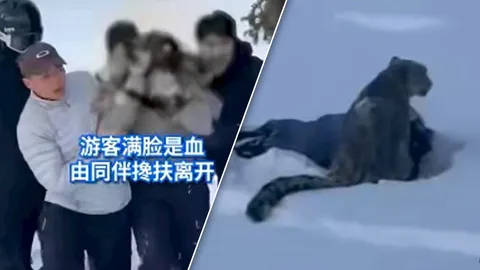 อาการหนัก "นักท่องเที่ยวหญิง" โดน "เสือดาวหิมะ" ขย้ำหน้า ในลานสกี (คลิป)