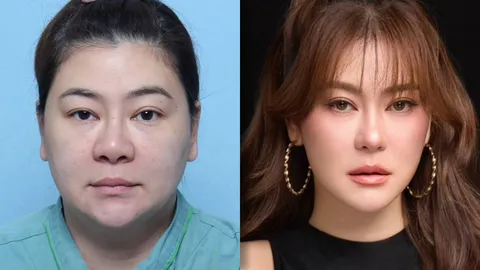 สุดจะจึ้ง!! โอ๋ ภัคจีรา ศัลยกรรม 6 จุด สวยย้อนวัย 10 ปี 