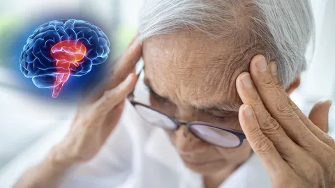 วิตามินดี ไม่ช่วยสมองเสื่อม แม้ในคนที่ขาดวิตามิน