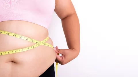 ผ่าตัดกระเพาะลดความอ้วน อันตรายแค่ไหน เช็กผลข้างเคียง-ภาวะซึมเศร้าที่อาจตามมา