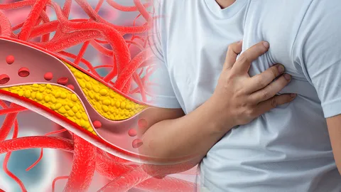 ยาลดไขมันฤทธิ์แรงเสี่ยงเบาหวาน ถ้าอ้วนไม่ฟิต