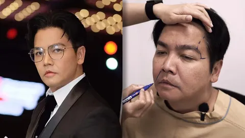 เปิดภาพล่าสุด พีเค ปิยะวัฒน์ ไลฟ์สดหลังทำศัลยกรรม ทำคนคอมเมนต์ชมหน้าเด็กมาก