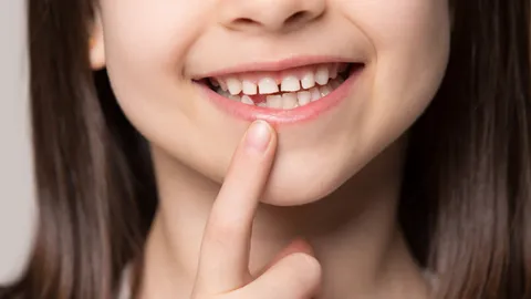 การรักษารากฟันน้ำนมในเด็ก