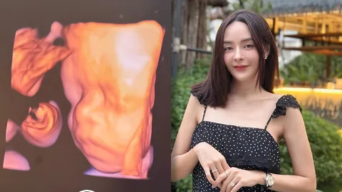 สำเนาถูกต้อง! ฝ้าย ภัทณชา อวดภาพอัลตร้าซาวด์ลูกสาว ลุ้นหน้าเหมือนใคร? 