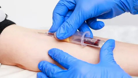 "สภาเทคนิคการแพทย์" ชี้แจงประเด็น "งดน้ำ-งดอาหาร" ก่อนการเจาะเลือด