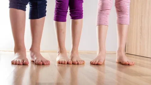ภาวะขาโก่งในเด็ก (Bow legs) หรือ เด็กขาโก่ง เกิดจากอะไร จำเป็นต้องผ่าตัดหรือไม่