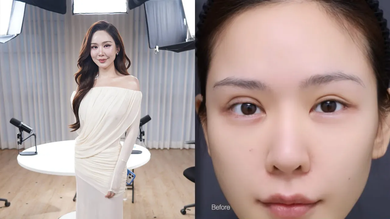 หลิน มาลิน ไม่กล้าส่องกระจก ถูกบูลลี่หนักหลังทำตา กลายเป็นปมในใจนาน 2 ปี