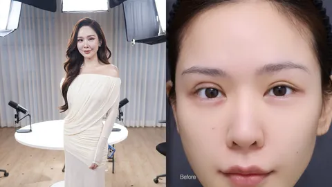 หลิน มาลิน ไม่กล้าส่องกระจก ถูกบูลลี่หนักหลังทำตา กลายเป็นปมในใจนาน 2 ปี