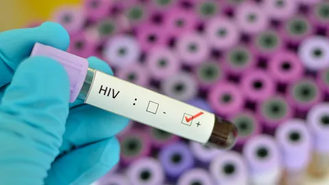 ชี้เพศสัมพันธ์ปลอดภัยสกัด HIV วัยรุ่น ห่วงผู้ติดเชื้อ 6 หมื่นรายไม่รู้ตัว ดันโมเดลคลินิกชุมชน