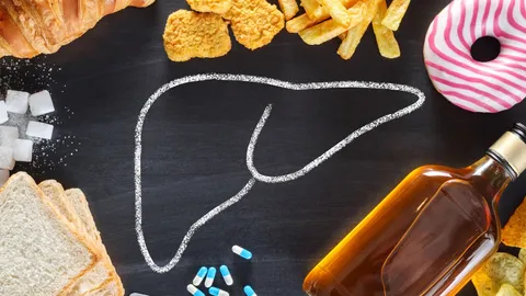 สายกินต้องระวัง! 5 อาหารตัวดีเสี่ยง “ไขมันพอกตับ” กินแค่ไหนถึงอันตราย