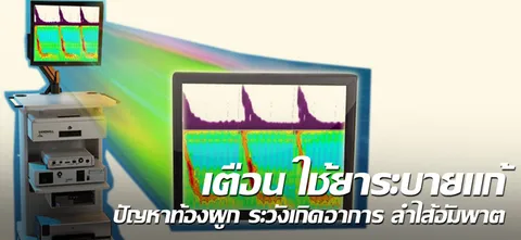 เตือน ใช้ยาระบายแก้ ปัญหาท้องผูก ระวังเกิดอาการ ลำไส้อัมพาต
