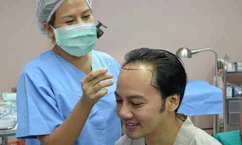 เทคนิคพิชิต'ศีรษะล้าน'