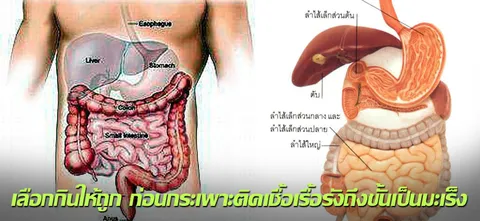 เลือกกินให้ถูก ก่อนกระเพาะติดเชื้อเรื้อรังถึงขั้นเป็นมะเร็ง