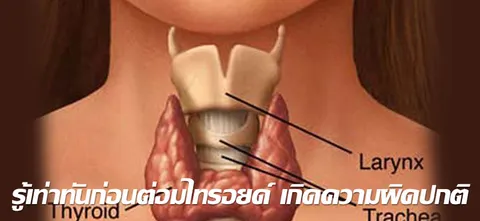 รู้เท่าทันก่อนต่อมไทรอยด์ เกิดความผิดปกติ 