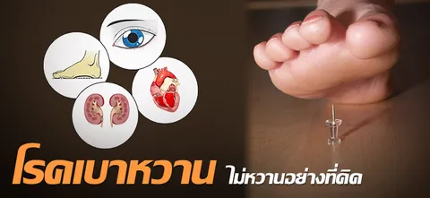 'โรคเบาหวาน' ไม่หวานอย่างที่คิด 