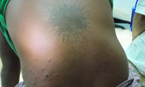 หนุ่มก่อสร้างตะลึง! ถูกยิงกระสุนไม่เข้า คาดปาฏิหาริย์รอยสัก