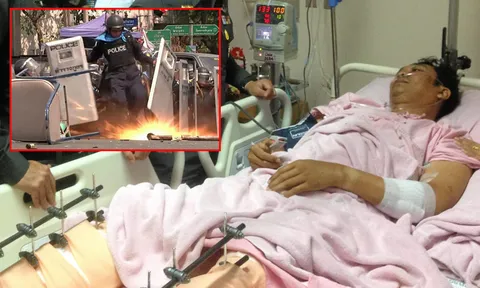 แพทย์รพ.ตร.เผย ดาบฮีโร่เตะระเบิด ยังรักษาขาไว้ได้