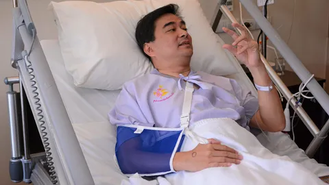 สะดุดล้ม