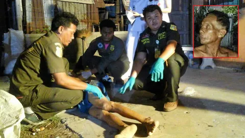 ฟันไส้ทะลัก ชายปากเสีย