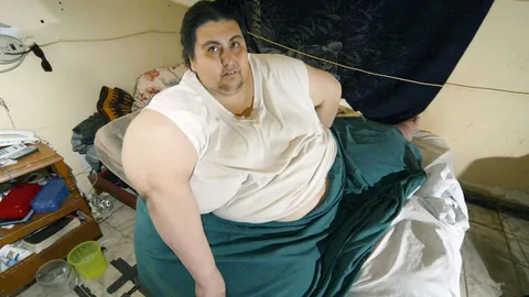 อดีตคนอ้วนสุดในโลกชาวเม็กซิโก เสียชีวิตแล้ว