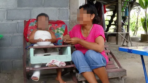 'ทูลกระหม่อมหญิงฯ' ช่วย ด.ช. 6 ขวบ ป่วยกระดูกผุ