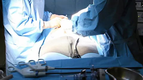 แพทย์หนุน 'ล้างไตผ่านช่องท้อง' อุ้มผู้ป่วยไตมีชีวิตดีขึ้น