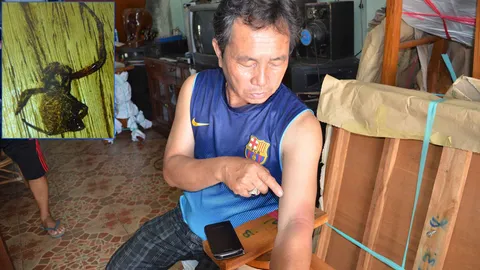 โดนกัดอีกราย เสี่ยแพร่ผวา เป็น 'แมงมุมแม่ม่ายสีน้ำตาล'