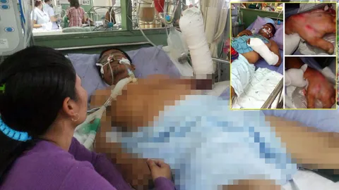 'แมงมุม'กัดอีก หนุ่มใหญ่ป่วยหนัก ญาติเชื่อเป็นสาเหตุ