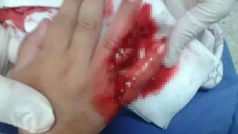 ปลางับเด็กเย็บ 20 เข็ม แหย่มือลงตู้โชว์ ห้างดูแล-ญาติไม่ติดใจ (ชมคลิป)