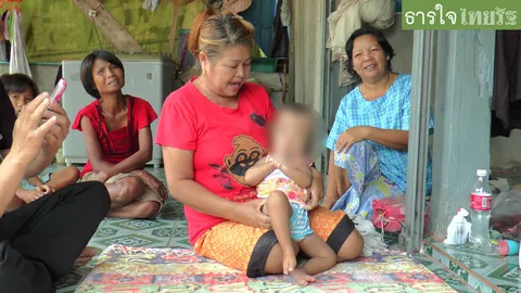 วอนช่วย ดญ.หัวโต ไม่มีกะโหลก-รูหู