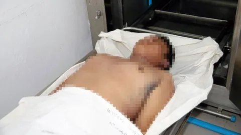 เข้มรับน้องนอกสถานที่ หวั่นนักศึกษาดับปริศนาซ้ำเทคนิคปทุมธานี