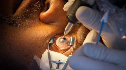 สักลายที่ “ลูกตา” ลบปมด้อย