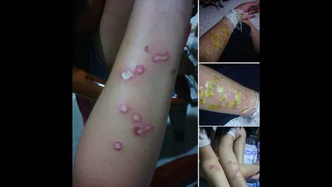 เจอโทษหนัก รุ่นพี่รับน้องโหด 'หยดน้ำตาเทียน' อาจพักการเรียน!