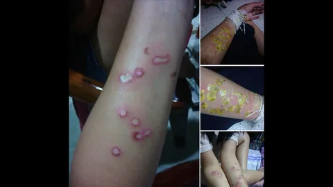 รุ่นพี่รับ 'หยดน้ำตาเทียน' รับน้องจริง-ถูกสอบวินัยแล้ว!