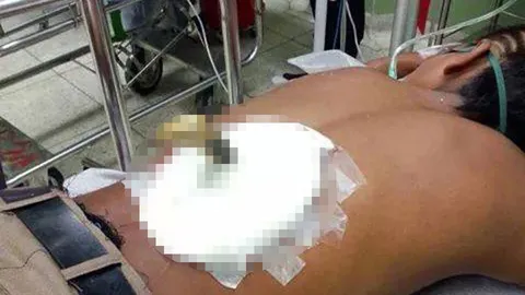 เสียว! มีดแทงมิดเหลือแต่ด้าม โจ๋ดูดนตรี ‘เอกชัย’