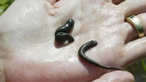 อึ้ง!! พบปลิง 3 นิ้ว ในรูจมูกสาวสกอต