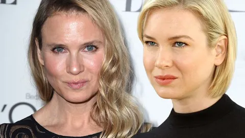 อั๊ยย่ะ ! เรเน่ เซลเวเกอร์ ดาราหญิงคนดัง เปลี่ยนไปจนจำไม่ได้