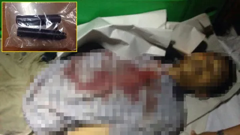 เด็กเทคโนฯ โดนรุ่นน้องทำปืนลั่นใส่เสียชีวิตแล้ว 