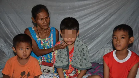 วอนช่วย ด.ช. 10 ขวบ เสี่ยงตาบอด รู้เท่าไม่ถึงการณ์ เก็บคอนแทคฯมาใส่