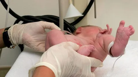 แพทย์ มช. ชู'nasoform'ช่วยเด็กปากแหว่งเพดานโหว่