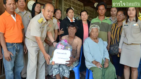 หนุ่มโคราชป่วยเป็นท้าวแสนปม อยู่กับแม่ชราโรครุมเร้า วอนคนใจบุญช่วย