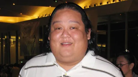 'โบ๊ท วิบูลย์นันท์' ยังอยู่ในห้องผ่าตัดเสี่ยง! แคลเซียมกดทับไขสันหลัง