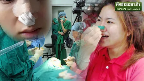 ดั้งโด่งจริงหรือ? เปิดพิษสงร้ายไม้หนีบผ้าดึงจมูก