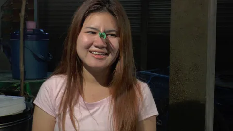 บุญหล่นทับ 'สาวตากหนีบดั้ง' คลินิกดังเชียงใหม่รับเสริมจมูกให้ฟรี!!