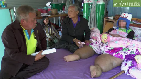 สุดเวทนา! สาว 17 ป่วยโรคขาโตนาน 3 ปี วอนช่วยเหลือ