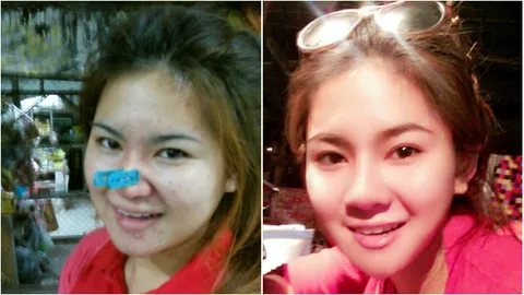 ยังสวยไม่พอ! 'เจนนี่' สาวหนีบดั้งขอทำคางเรียว หนุ่มๆ รุมจีบ 