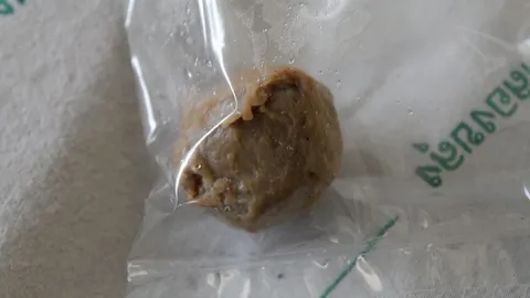 ลูกชิ้นปิงปอง ติดคอดับทุรน