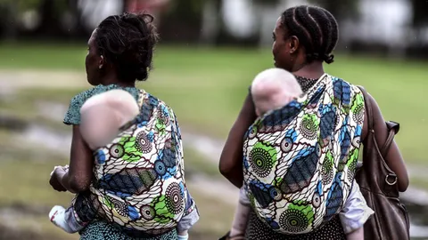 แทนซาเนียเร่งปราบฆ่า‘คนเผือก’ รวบ ‘พ่อมดหมอผี’  หวังซื้ออวัยวะเสริมดวง!