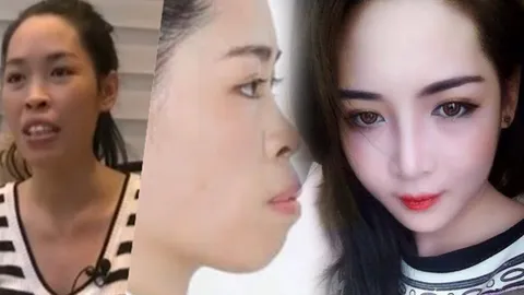 ทำหน้าสวยชาตินี้! ขยี้ตา 2 ทีเพื่อลบภาพเก่า ศัลยกรรมเปลี่ยนชีวิต 
