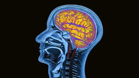 ข้าวคอยฝน ยาแก้สมองฝ่อ